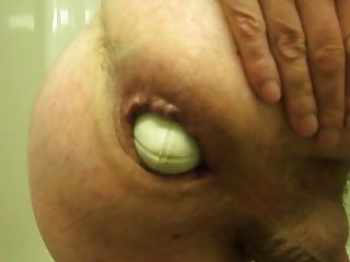 Prolapse Large Anal Fist Insertion Extreme Stretch Weird